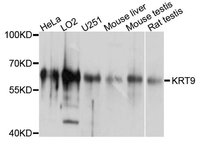 KRT9 Antibody in Western Blot (WB)