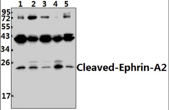 Ephrin A2 (Cleaved Asn188) Antibody in Western Blot (WB)