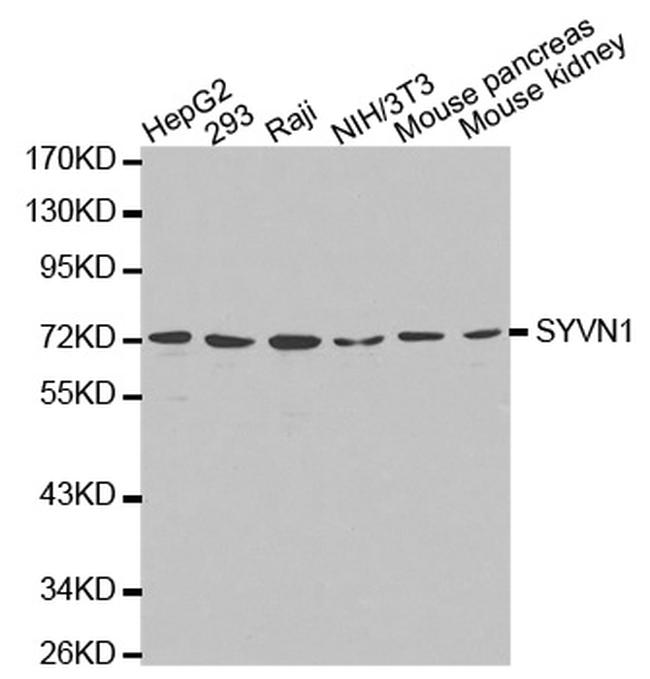 HRD1 Antibody in Western Blot (WB)