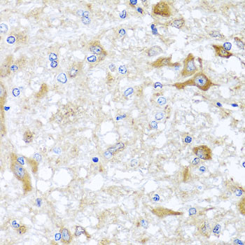 ABCB8 Antibody in Immunohistochemistry (Paraffin) (IHC (P))