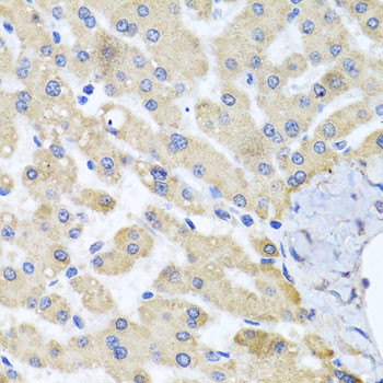 ABCB8 Antibody in Immunohistochemistry (Paraffin) (IHC (P))