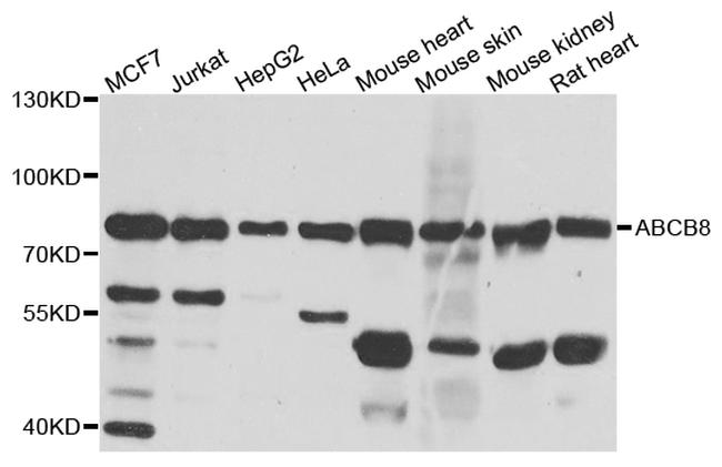 ABCB8 Antibody in Western Blot (WB)