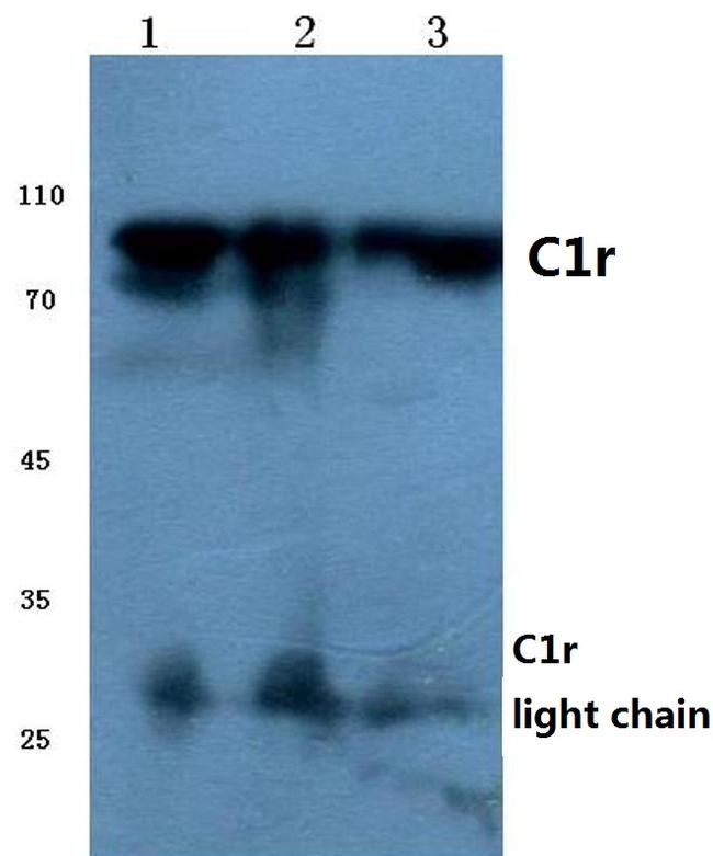 C1r Antibody in Western Blot (WB)