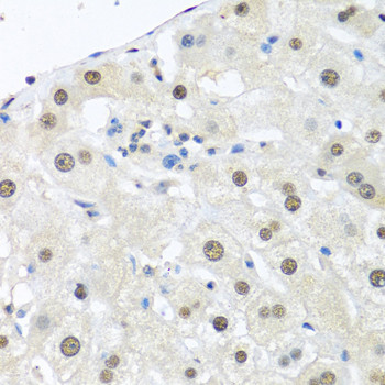 Ubiquitin C Antibody in Immunohistochemistry (Paraffin) (IHC (P))