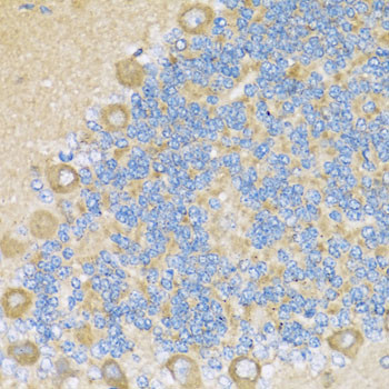 COX6A1 Antibody in Immunohistochemistry (Paraffin) (IHC (P))