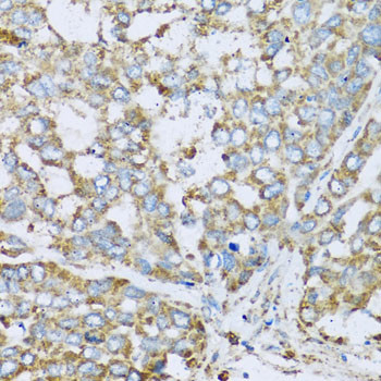 COX6A1 Antibody in Immunohistochemistry (Paraffin) (IHC (P))