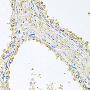 PMM2 Antibody in Immunohistochemistry (Paraffin) (IHC (P))