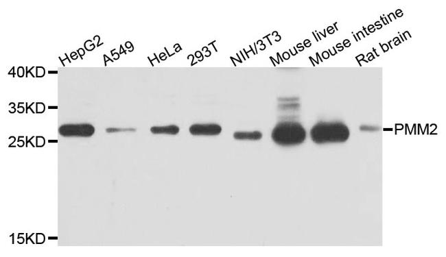 PMM2 Antibody in Western Blot (WB)