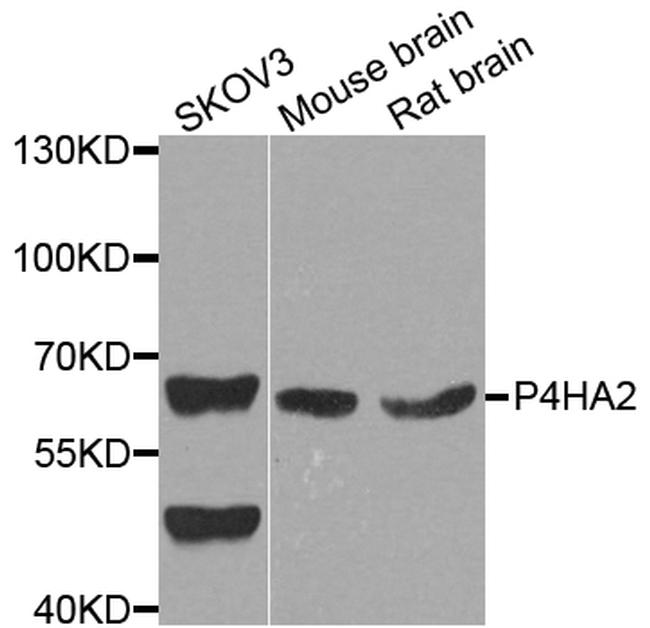 P4HA2 Antibody in Western Blot (WB)