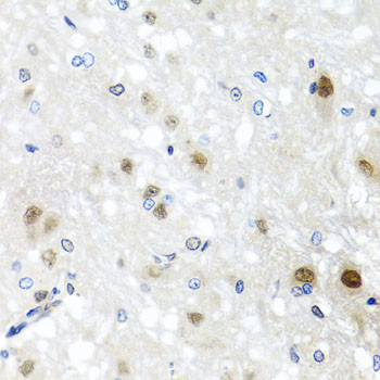 SAFB2 Antibody in Immunohistochemistry (Paraffin) (IHC (P))