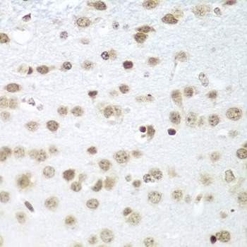 SAP18 Antibody in Immunohistochemistry (Paraffin) (IHC (P))