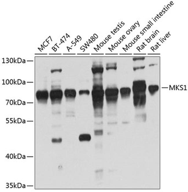 MKS1 Antibody in Western Blot (WB)