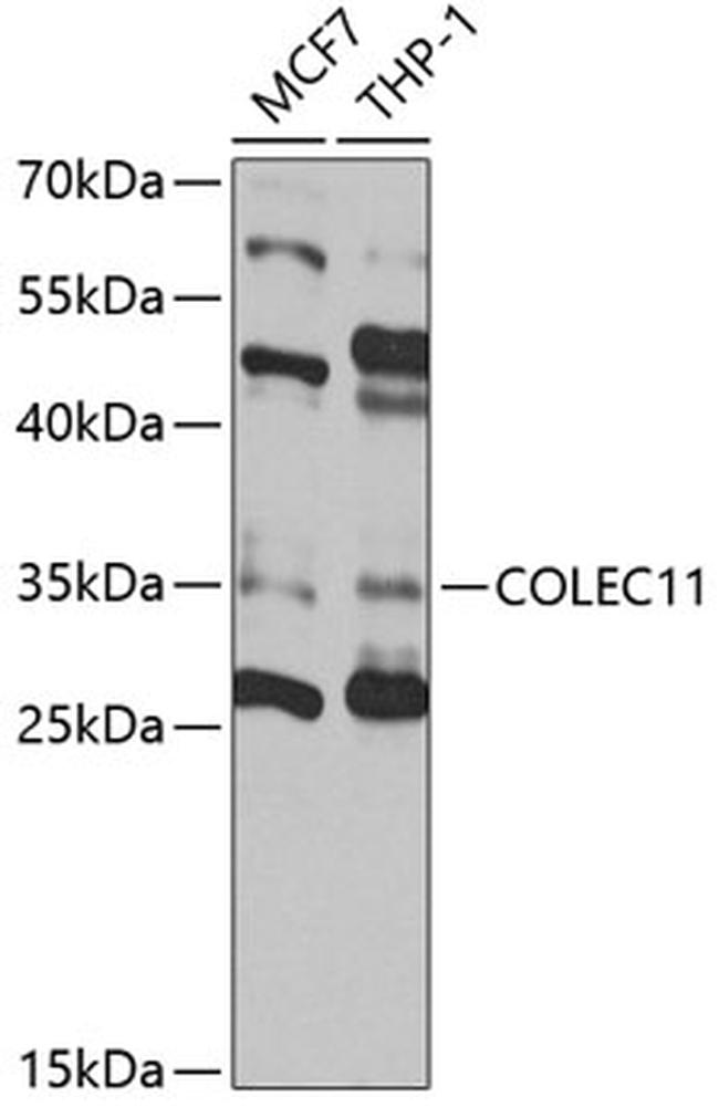 COLEC11 Antibody in Western Blot (WB)