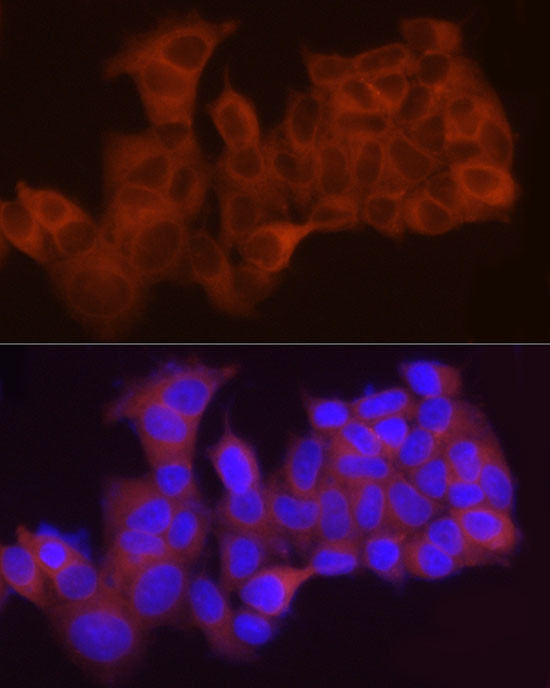 LPCAT1 Antibody in Immunocytochemistry (ICC/IF)