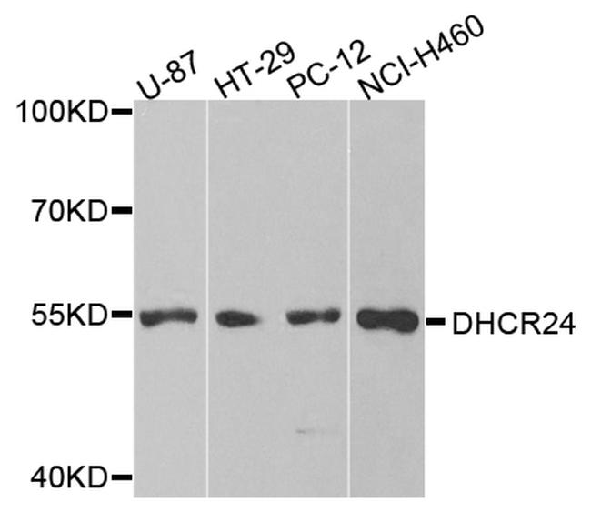 DHCR24 Antibody in Western Blot (WB)