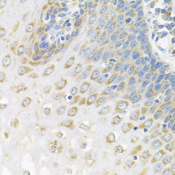 PABPC4 Antibody in Immunohistochemistry (Paraffin) (IHC (P))