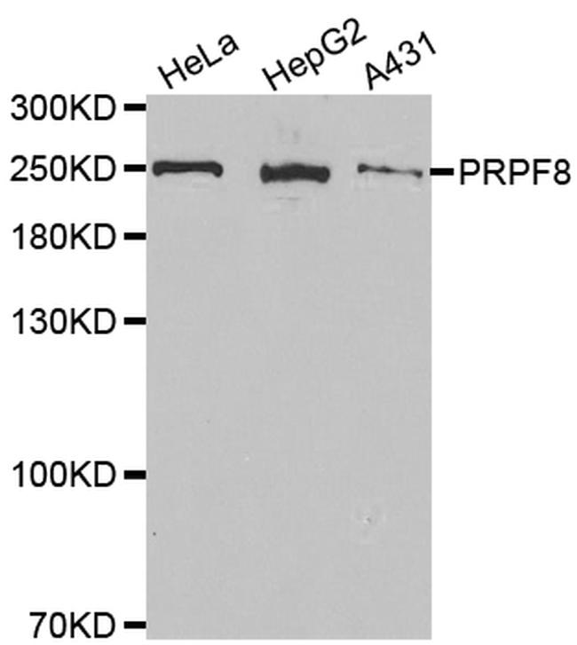 PRP8 Antibody in Western Blot (WB)