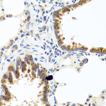 C8orf4 Antibody in Immunohistochemistry (Paraffin) (IHC (P))