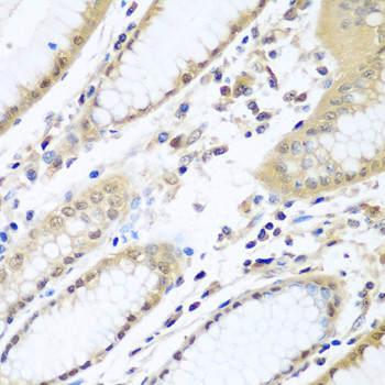 WDR48 Antibody in Immunohistochemistry (Paraffin) (IHC (P))