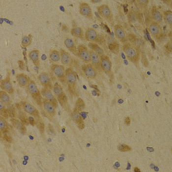 SCO2 Antibody in Immunohistochemistry (Paraffin) (IHC (P))