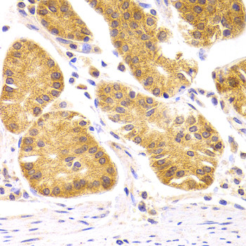 SCO2 Antibody in Immunohistochemistry (Paraffin) (IHC (P))