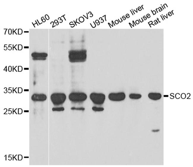 SCO2 Antibody in Western Blot (WB)