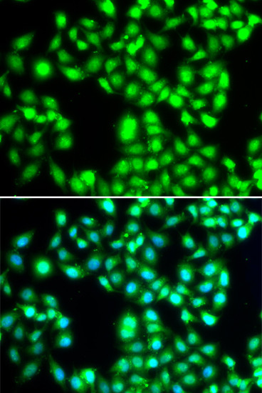 YTHDC1 Antibody in Immunocytochemistry (ICC/IF)