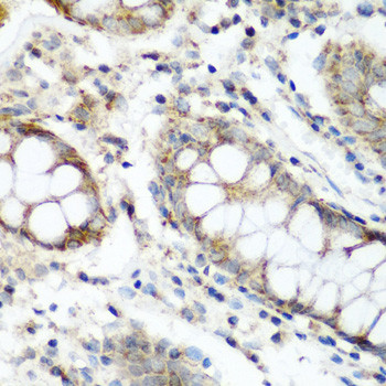 NAT15 Antibody in Immunohistochemistry (Paraffin) (IHC (P))