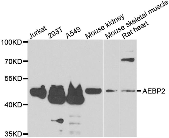 AEBP2 Antibody in Western Blot (WB)