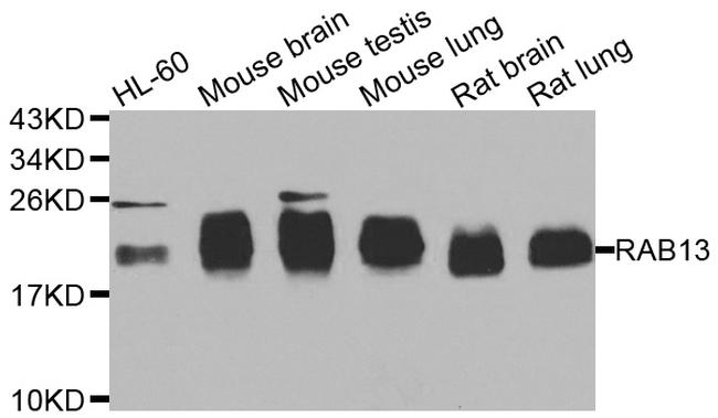 RAB31 Antibody in Western Blot (WB)