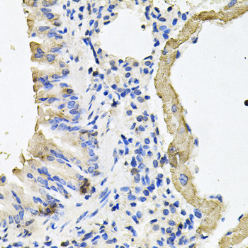 MYH7 Antibody in Immunohistochemistry (Paraffin) (IHC (P))