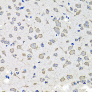 C1GALT1C1 Antibody in Immunohistochemistry (Paraffin) (IHC (P))