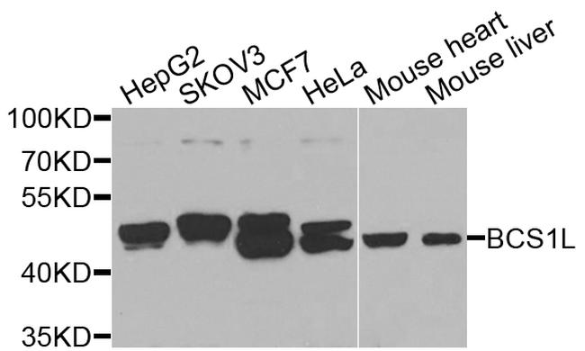 BCS1L Antibody in Western Blot (WB)