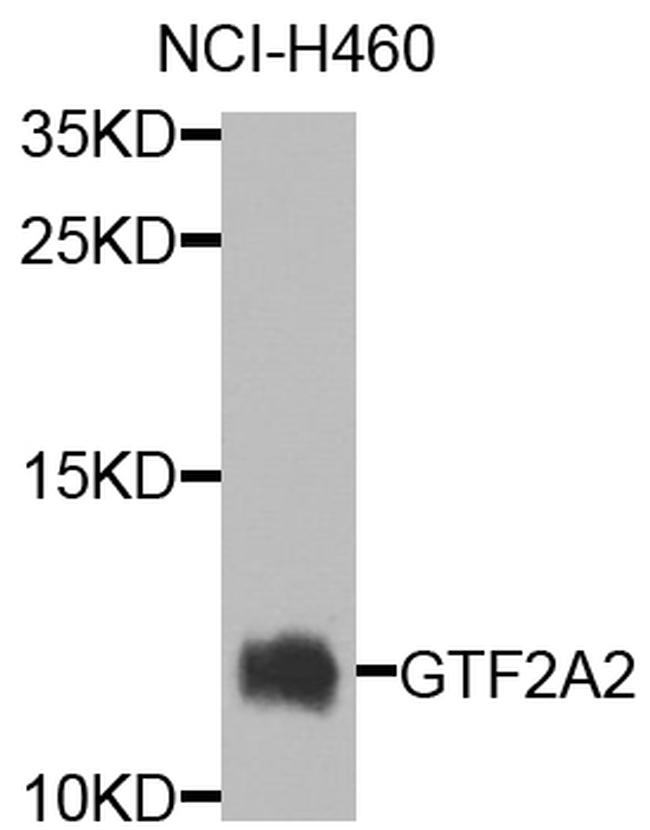 GTF2A2 Antibody in Western Blot (WB)