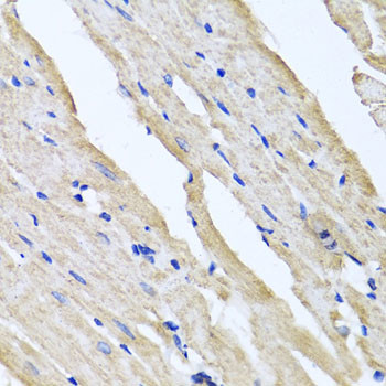 RCN2 Antibody in Immunohistochemistry (Paraffin) (IHC (P))