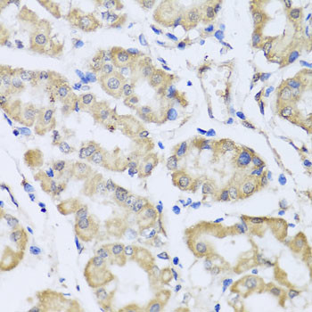 RCN2 Antibody in Immunohistochemistry (Paraffin) (IHC (P))