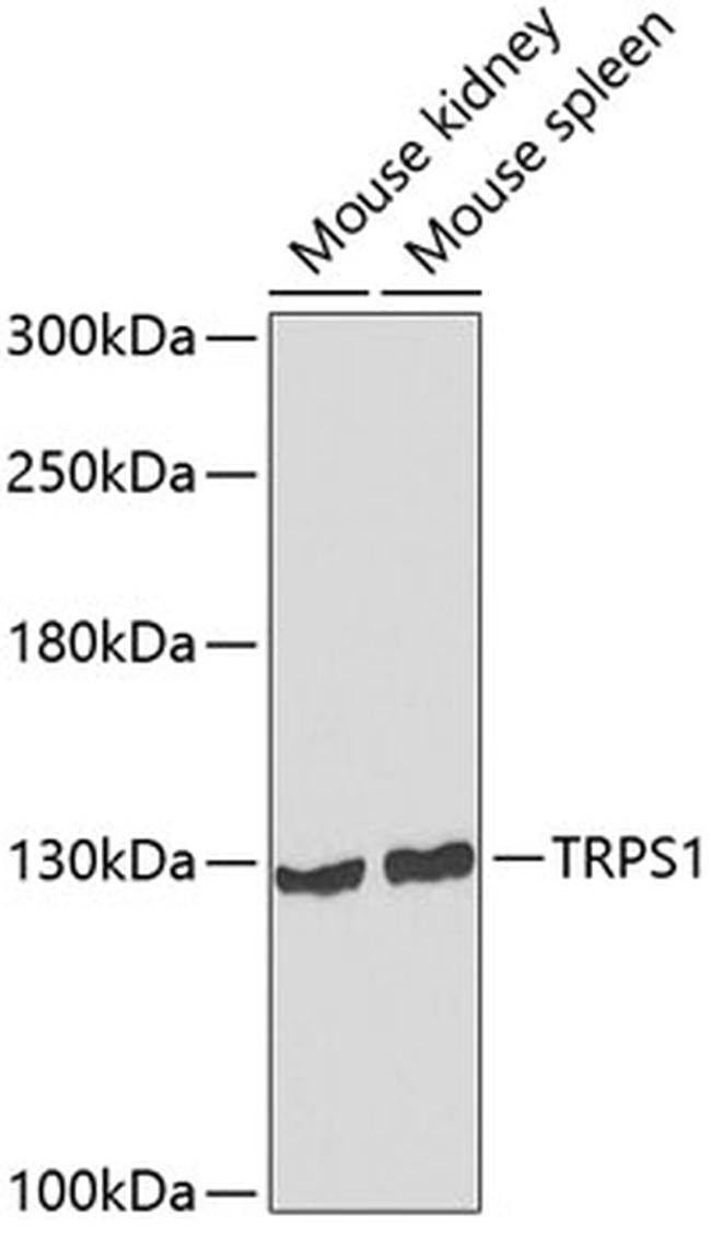 TRPS1 Antibody in Western Blot (WB)