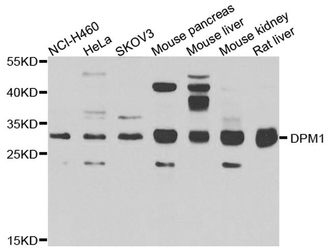 DPM1 Antibody in Western Blot (WB)