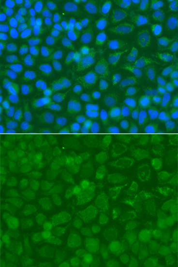 ACAD9 Antibody in Immunocytochemistry (ICC/IF)