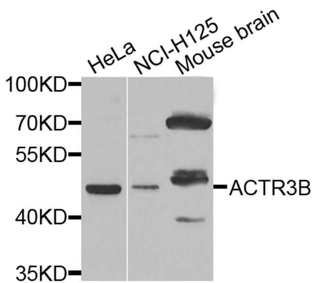 ACTR3B Antibody in Western Blot (WB)