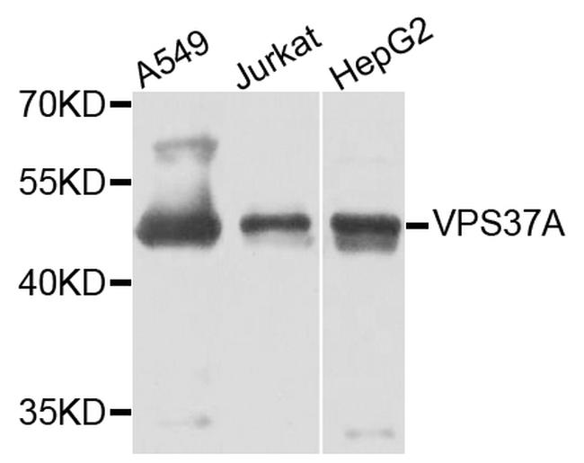 VPS37A Antibody in Western Blot (WB)