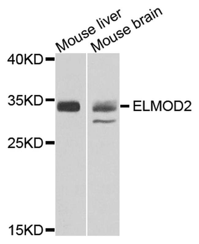 ELMOD2 Antibody in Western Blot (WB)