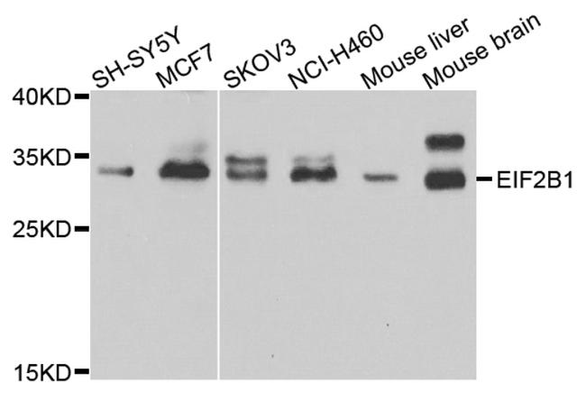 eIF2b alpha Antibody in Western Blot (WB)