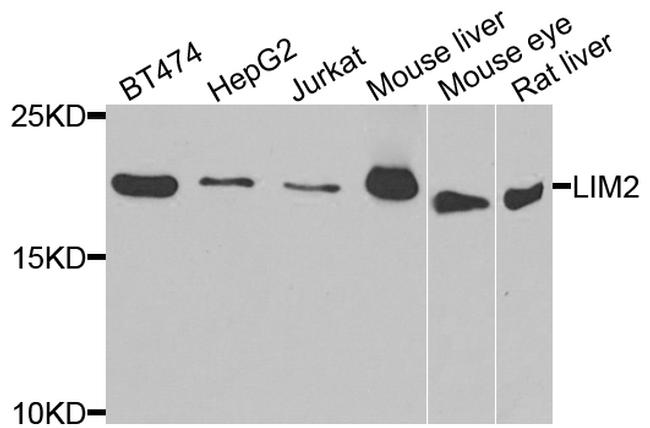 LIM2 Antibody in Western Blot (WB)