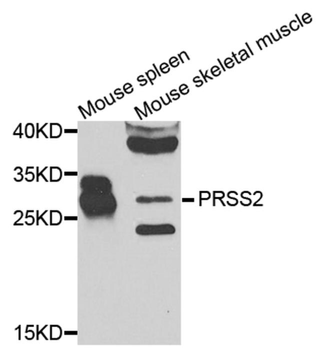 Trypsin 2 Antibody in Western Blot (WB)