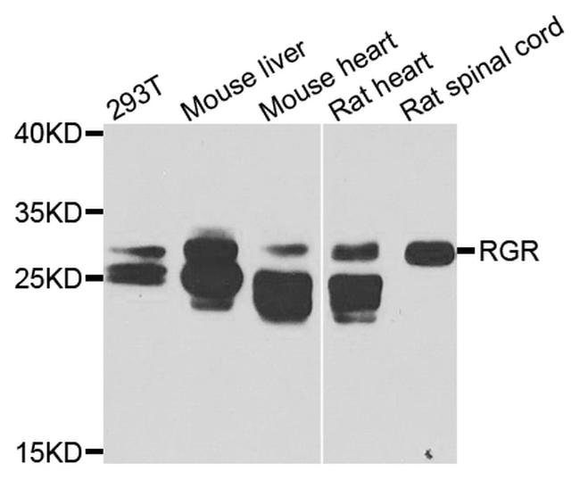 RGR Antibody in Western Blot (WB)