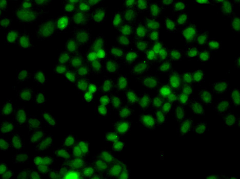 PIP5K1A Antibody in Immunocytochemistry (ICC/IF)