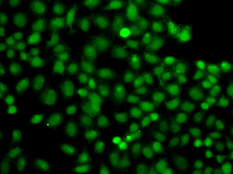 PIP5K1A Antibody in Immunocytochemistry (ICC/IF)