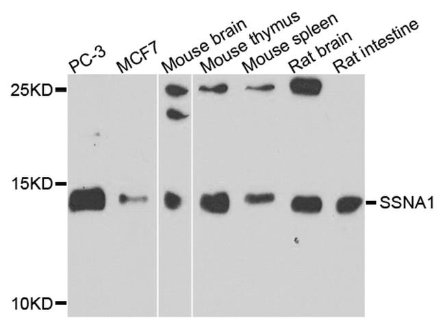 SSNA1 Antibody in Western Blot (WB)