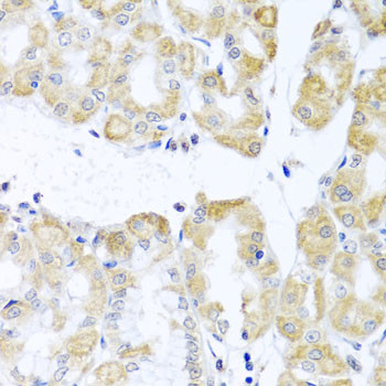 DDX39 Antibody in Immunohistochemistry (Paraffin) (IHC (P))